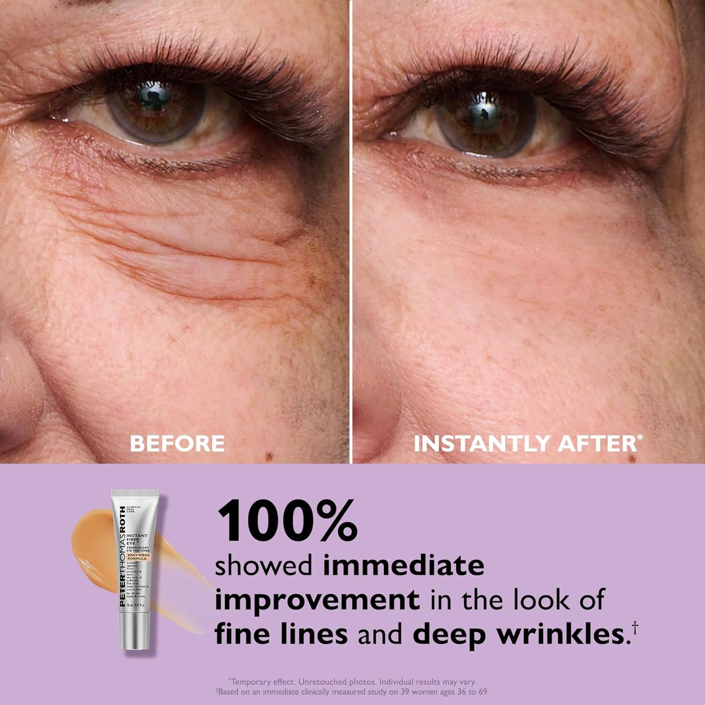 Eye Tightening Gel - Instant Temporary Smoothing Effect For Under-Eye Bags & Wrinklesa